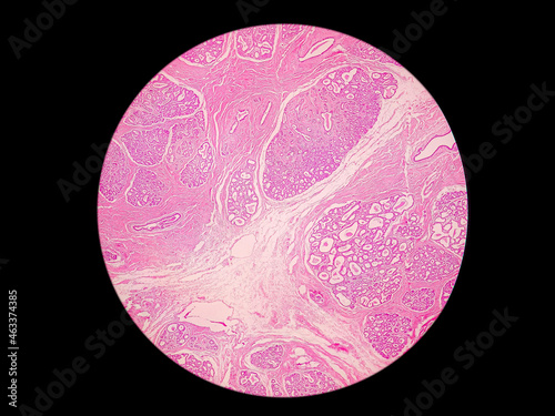 Histology of human mammary gland : educational microscopic (LM) image