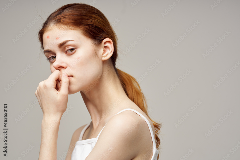 red-haired woman with pimples on the face hygiene isolated background red-haired woman with pimples on the face hygiene isolated background