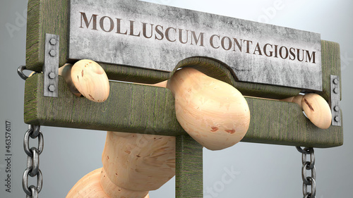 Molluscum contagiosum impact and social influence shown as a figure in pillory to demonstrate Molluscum contagiosum's effect on health and burden it brings to life, 3d illustration photo