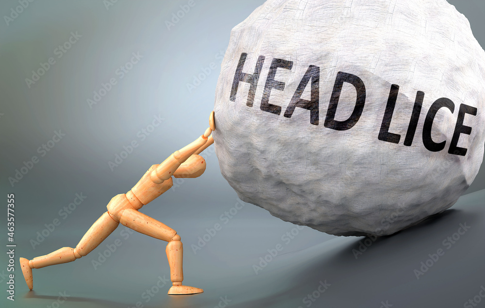 Head lice depiction, impression and presentation of this condition shown a wooden model