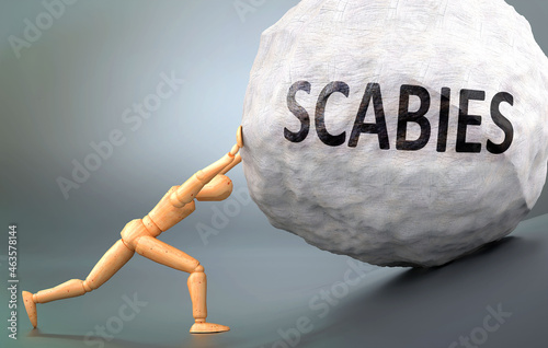 Scabies - depiction, impression and presentation of this condition shown a wooden model pushing heavy weight to symbolize struggle and pain when dealing with Scabies, 3d illustration photo