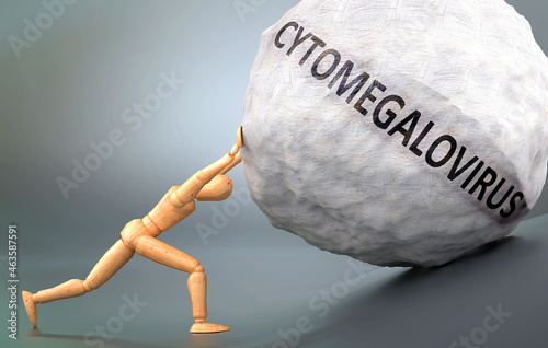 Cytomegalovirus - depiction, impression and presentation of this condition shown a wooden model pushing heavy weight to symbolize struggle and pain when dealing with Cytomegalovirus, 3d illustration photo
