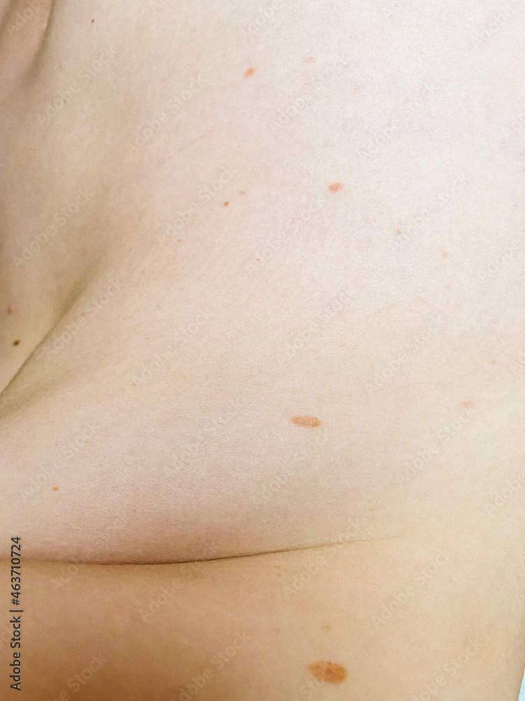 Moles 2 Moles 2