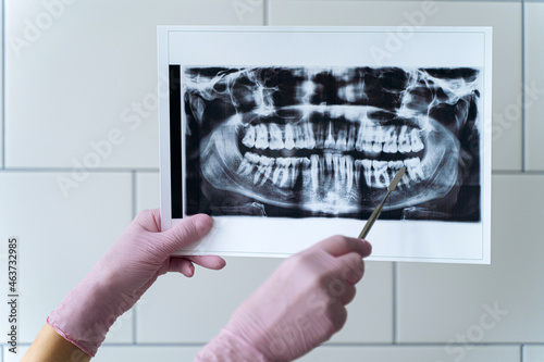 Doctor showing teeth X ray