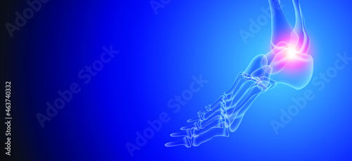 Illustration of Arthritis ankle joint . Rheumatoid arthritis.  Human bone anatomy flat vector illustration on a blue technology background. 3d rendered medically accurate illustration.
