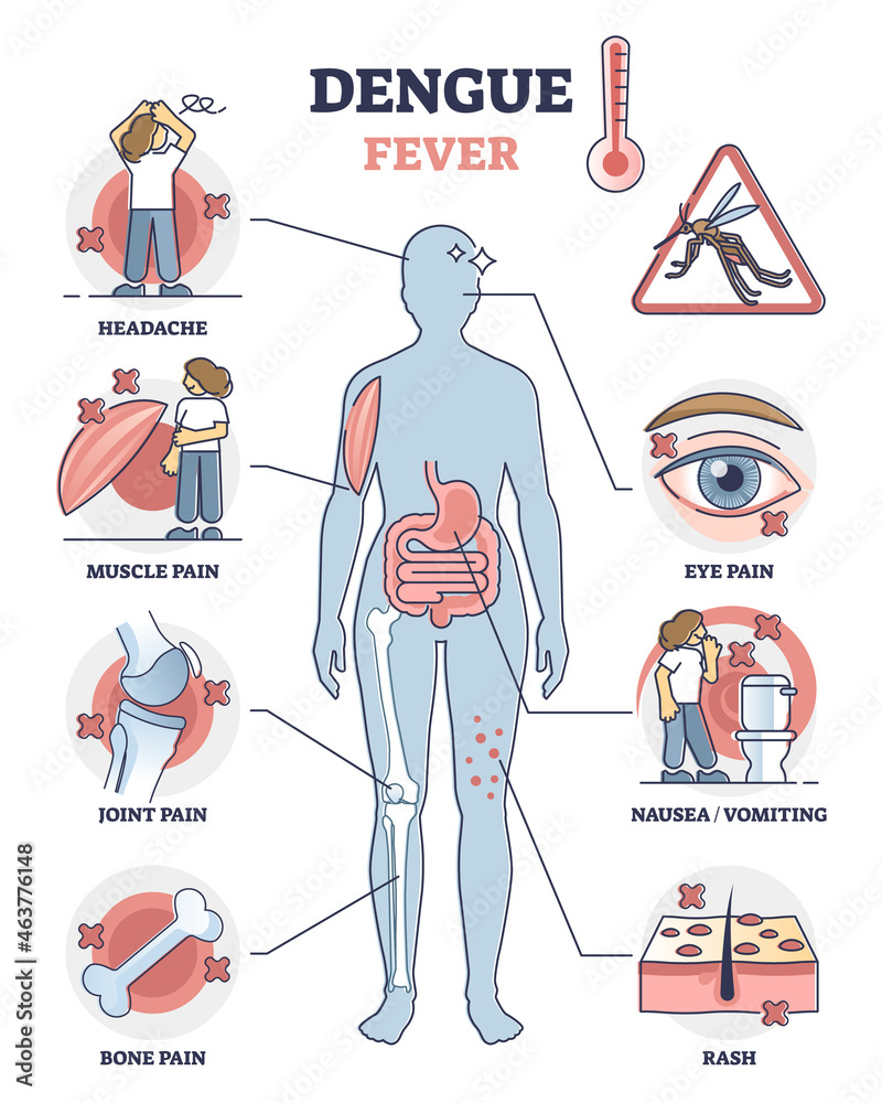 Dengue fever symptoms awareness poster, educational vector illustration