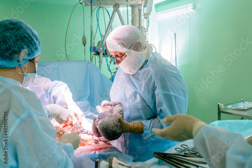 Surgical team performing surgery operation. Male doctor performing surgery using sterilized equipment. Gynecologists and midwifes giving birth. Infant in maternity hospital. photo