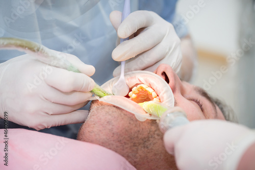 Dental clinic. Doctor dentist treats teeth to the patient in the dental clinic. Dentistry and orthodontist. Dental treatment and bite correction.