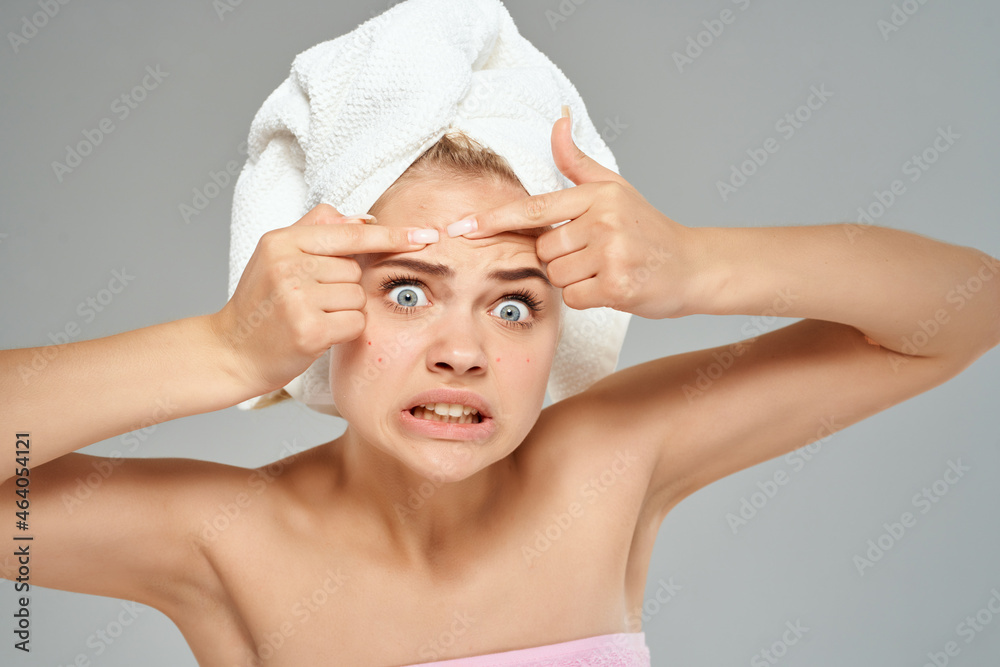 beautiful woman with a towel on my head acne on the face Studio close-up beautiful woman with a towel on my head acne on the face Studio close-up