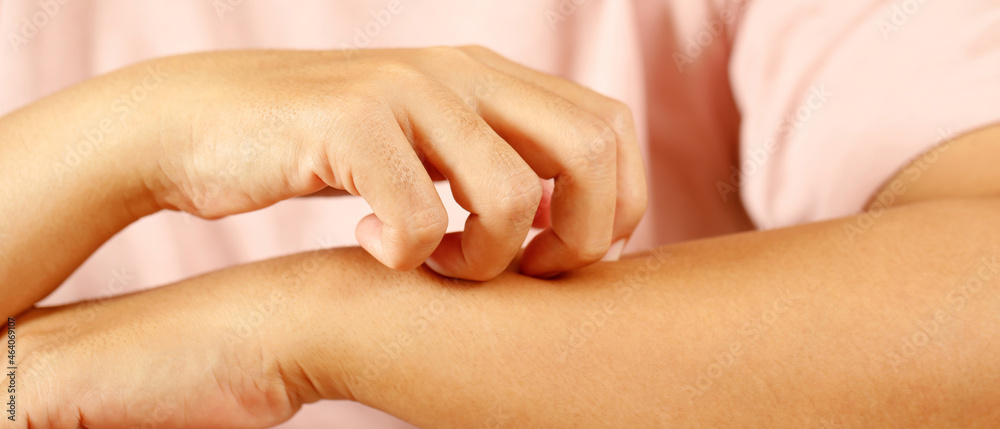 Fototapeta premium Health problems, woman has itchy hands