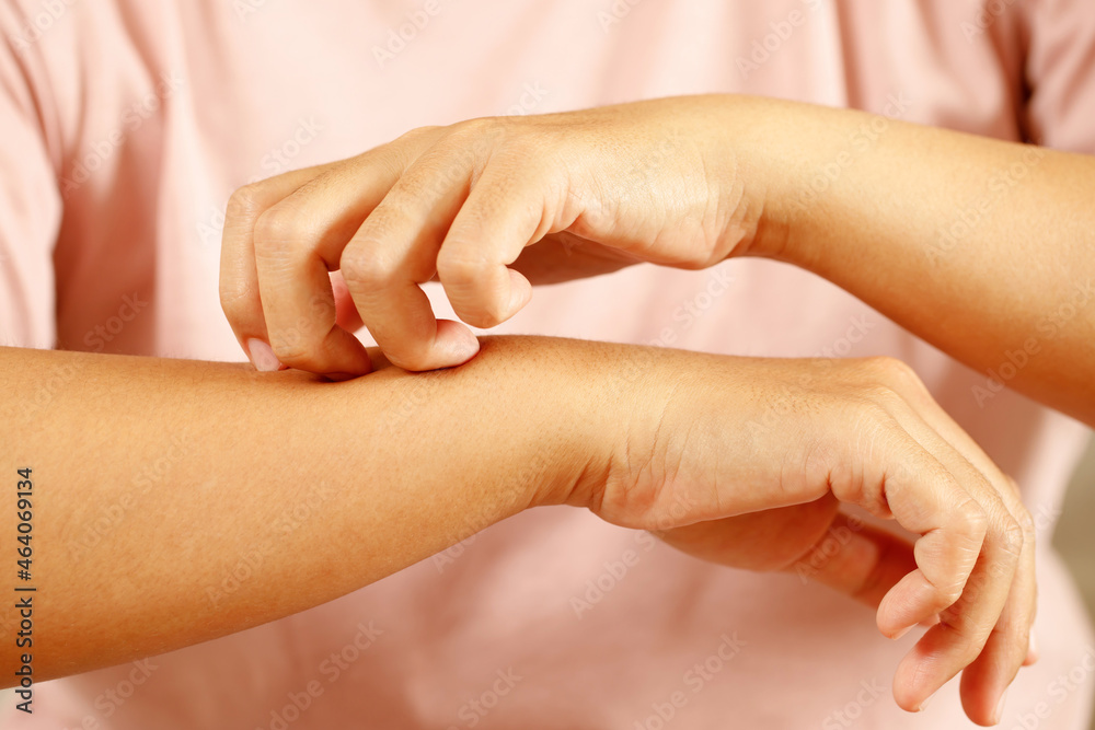 Fototapeta premium Health problems, woman has itchy hands