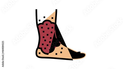 stasis dermatitis animated color icon. stasis dermatitis sign. isolated on white background