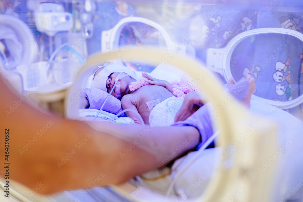 New born premature baby girl in intensive care unit in a medical incubator under ultraviolet lamp. Phototherapy treatment to reduce bilirubin levels in newborn jaundice. Neonatal icu. - obrazy, fototapety, plakaty 