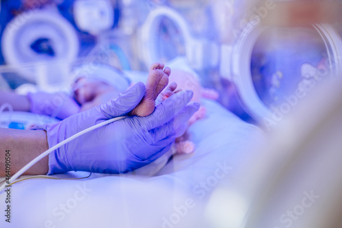 Macro photo of doctor\'s hands and legs of a child. Newborn is placed in the incubator. Neonatal intensive care unit
