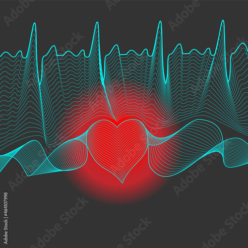 Electrocardiogram monitoring concept