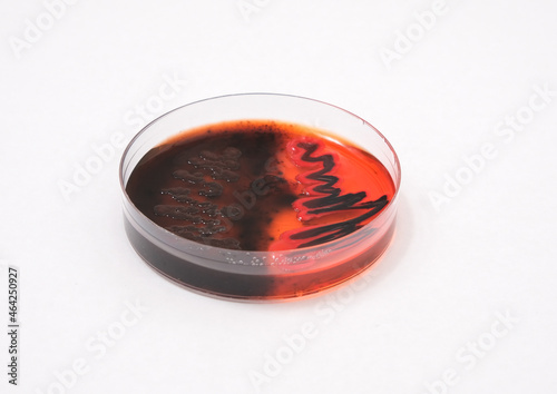 photo of growth of black bacterial colonies on macconkey agar photo