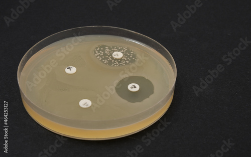 photo of growth of bacterial colonies around antibiotic discs photo