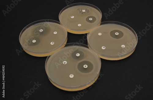 photo of growth of bacterial colonies around antibiotic discs photo