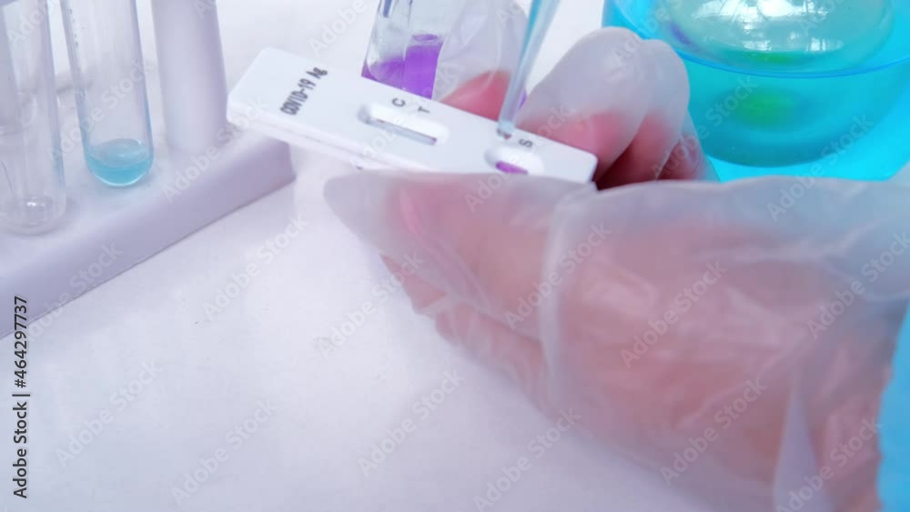 laboratory assistant doing a test for covid19, test tubes, glass vials