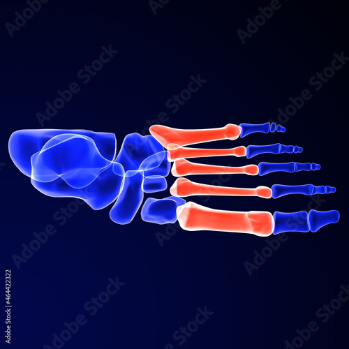 The metatarsal bones, or metatarsus, are a group of five long bones in the foot, located between the tarsal bones of the hind- and mid-foot and the phalanges of the toes.