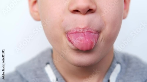 close-up of lower part of face, boy, child 8 years old opened his mouth, stuck out tongue, desquamative glossitis, performs articulation exercises for tongue, vocals, dental concept, speech therapy
