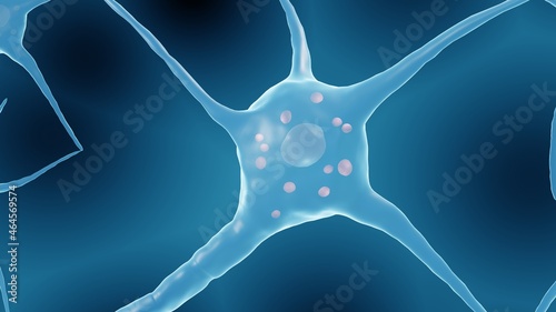 Lewy bodies in a neuron, Accumulations of proteins that develop inside nerve cells in parkinson's disease or dementia.