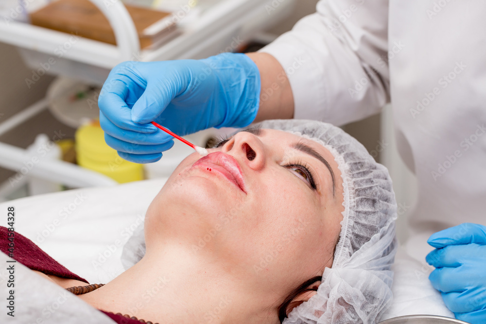 Lip augmentation. Beautician injects hyaluronic acid into the lips of a girl with a syringe. The cosmetologist doctor performs the procedure in the cosmetology office. Plastic surgery.