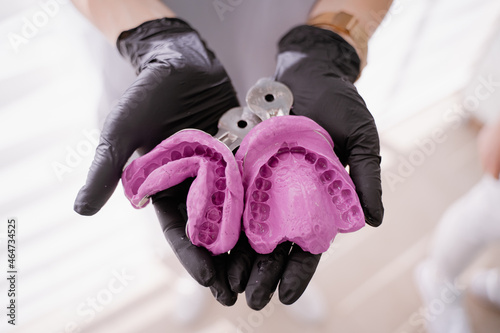 Two dental impressions in the hands of the orthodontist. Dental impressions of the upper and lower jaw made of silicone material. High precision dentition imprint.