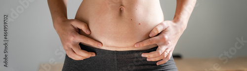 Fotografia Woman abdomen with cesarean scar