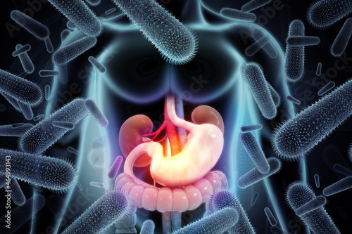 Stomach infection and gastroenteritis or gastro by a viral bacterial illness. 3d illustration photo