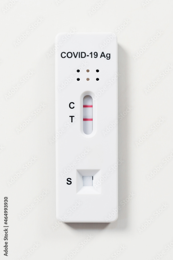 Coronavirus (Covid19) positive test result with SARSCoV2 Antigen