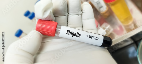 Blood sample tube for Shigella test, Shigella infection or shigellosis photo