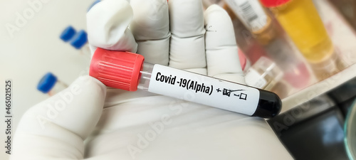 Alpha variant COVID-19 positive  blood sample tube positive with alpha variant or United Kingdom strain COVID-19