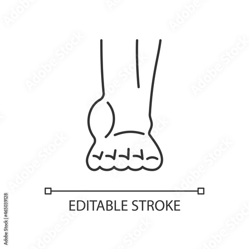 Ankle inflammation linear icon. Swollen foot and ankle. Osteoarthritis development. Tendonitis. Thin line customizable illustration. Contour symbol. Vector isolated outline drawing. Editable stroke