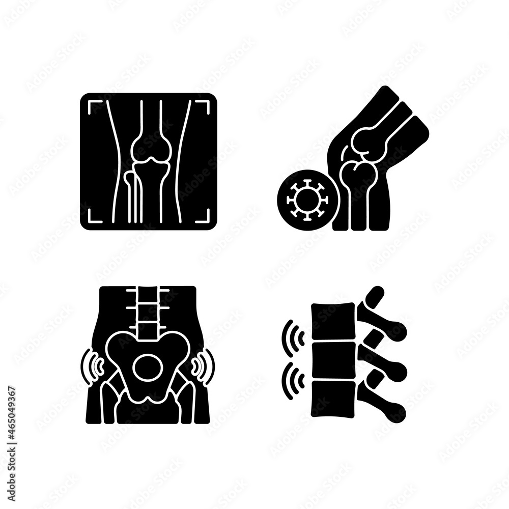 Extreme aching in bones black glyph icons set on white space. Arthritis x ray. Infectious joint disease. Hips rheumatism. Ankylosing spondylitis. Silhouette symbols. Vector isolated illustration Extreme aching in bones black glyph icons set on white space. Arthritis x ray. Infectious joint disease. Hips rheumatism. Ankylosing spondylitis. Silhouette symbols. Vector isolated illustration