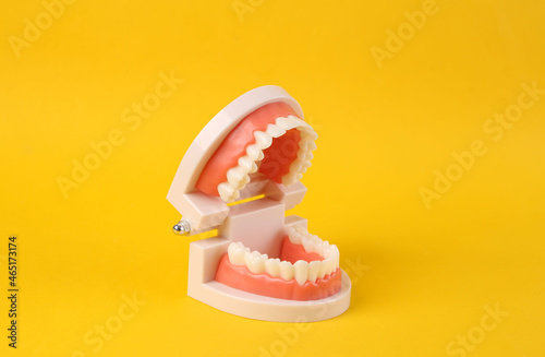 Anatomical model of a human jaw with white teeth on yellow background