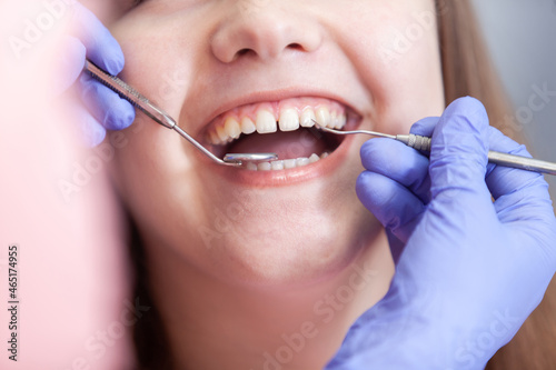 Close-up woman smiling on checkup at dentist in dental clinic