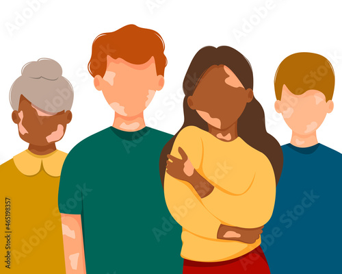 Group of vitiligo people isolated on white background. Concept of skin depigmentation, pigment of skin, body positive. World vitiligo day. 