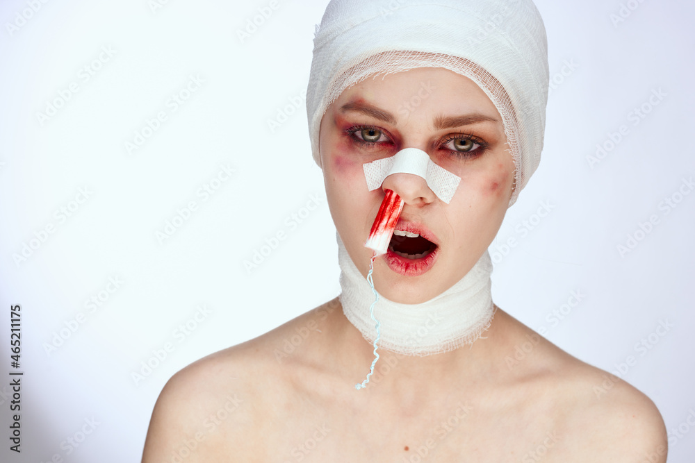 woman plastic surgery operation bare shoulders light background woman plastic surgery operation bare shoulders light background