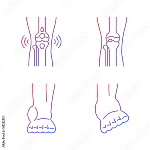 Arthritis leg pain gradient linear vector icons set. Degenerative joint disease. Bursitis condition. Muscles strains. Thin line contour symbols bundle. Isolated outline illustrations collection