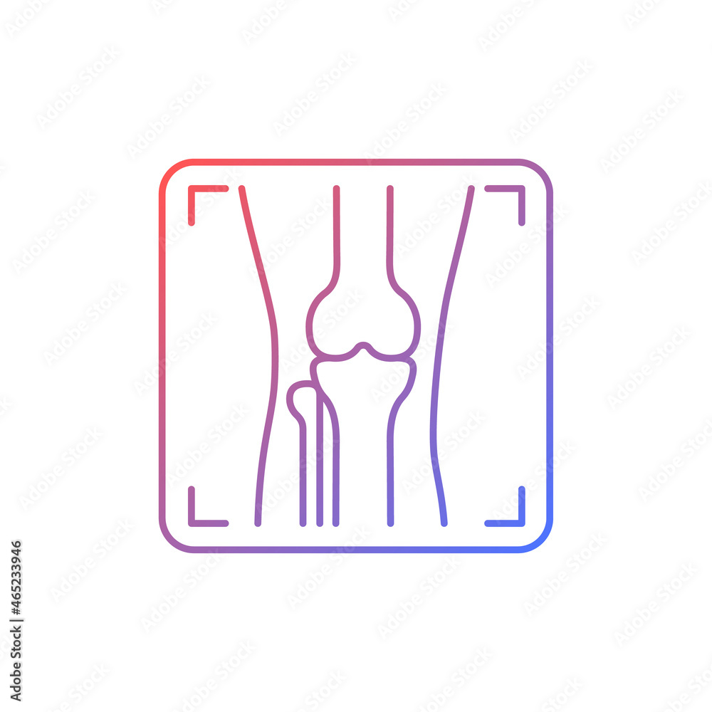 Arthritis x ray gradient linear vector icon. Joint deformity depiction. Osteoarthritis diagnosis. Medical imaging. Thin line color symbol. Modern style pictogram. Vector isolated outline drawing - obrazy, fototapety, plakaty 