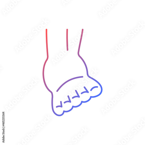 Joint sprain gradient linear vector icon. Ankle ligaments tearing. Sports injury. Overstretched joint. Muscle damage. Thin line color symbol. Modern style pictogram. Vector isolated outline drawing