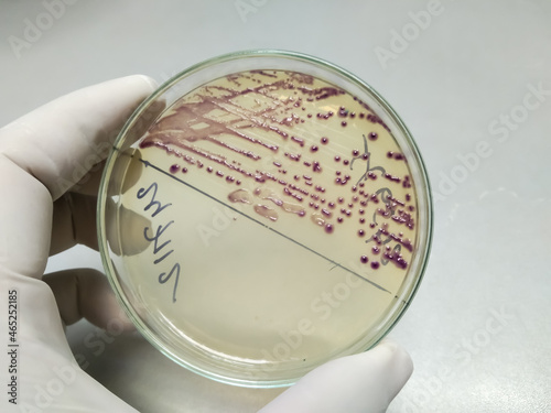 Bacteria colony of Escherichia coli (E.coli) in culture media plate photo