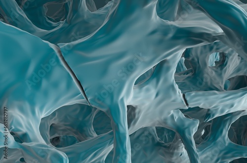 Fracture bones in osteoporosis - closeup view 3d illustration 