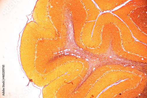 Foto Cerebellum, Thalamus, Medulla oblongata, Spinal cord and Motor Neuron human under the microscope in Lab