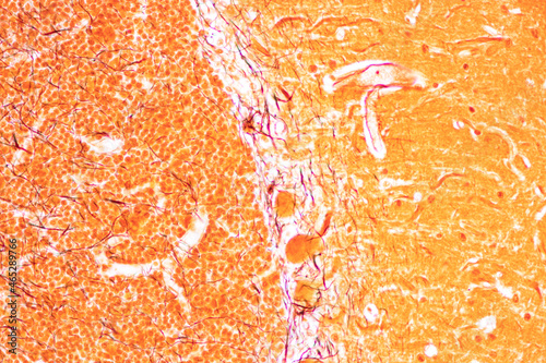 Cerebellum, Thalamus, Medulla oblongata, Spinal cord and Motor Neuron human under the microscope in Lab.
 photo