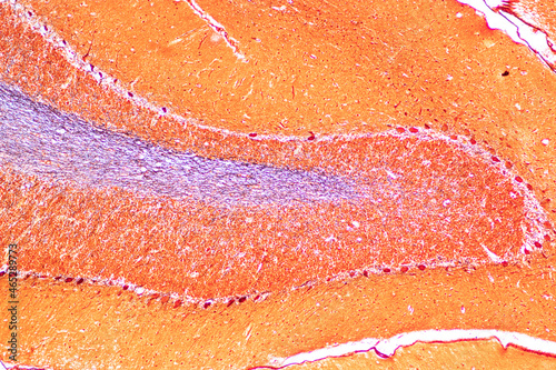 Fotografía Cerebellum, Thalamus, Medulla oblongata, Spinal cord and Motor Neuron human under the microscope in Lab
