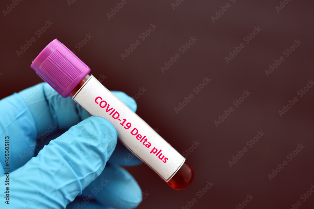 Fototapeta premium Delta plus COVID-19 positive, blood sample positive with delta plus variant of COVID-19 coronavirus
