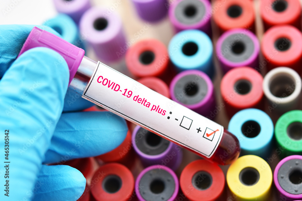 Obraz premium Delta plus COVID-19 positive, blood sample positive with delta plus variant of COVID-19 coronavirus