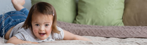 Toddler kid with down syndrome looking at camera on bed, banner. © LIGHTFIELD STUDIOS